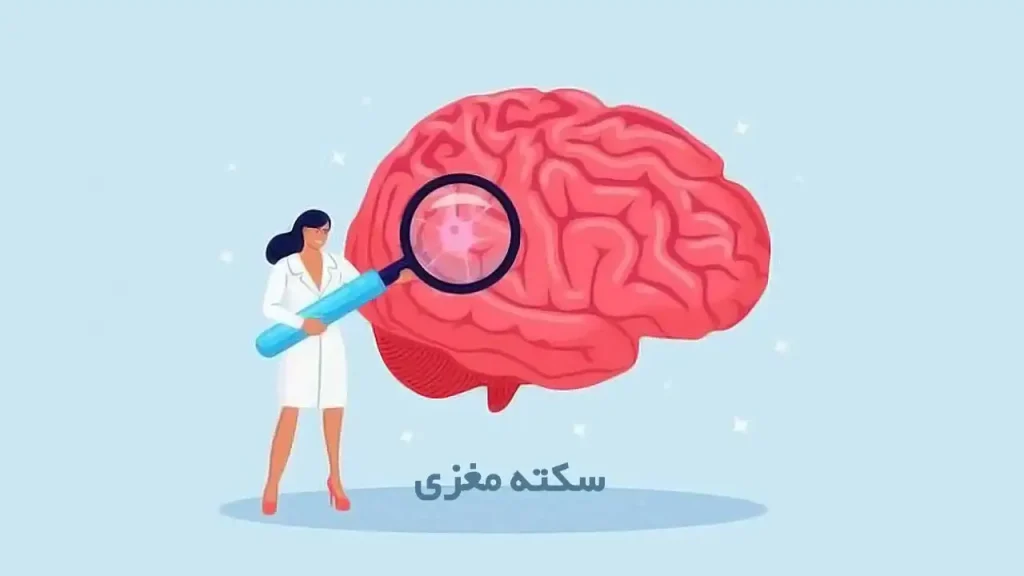 بررسی علائم سکته مغزی توسط بهترین متخصص مغز و اعصاب ایران 