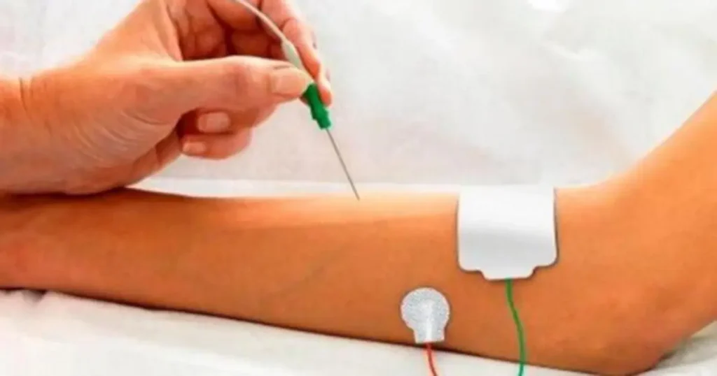 نوار عصب و عضله با بیمه تکمیلی آیا انجام می شود