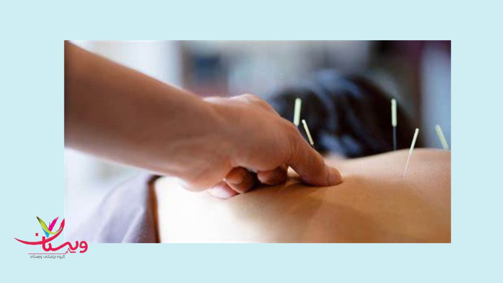 مزایای امبدینگ 