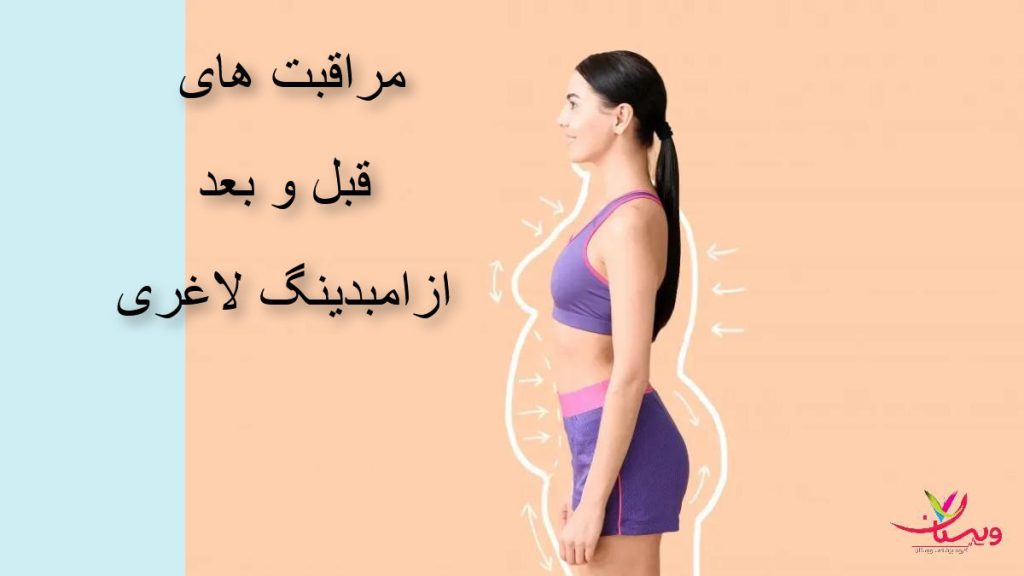 مراقبت های قبل وبعد از امبدینگ 