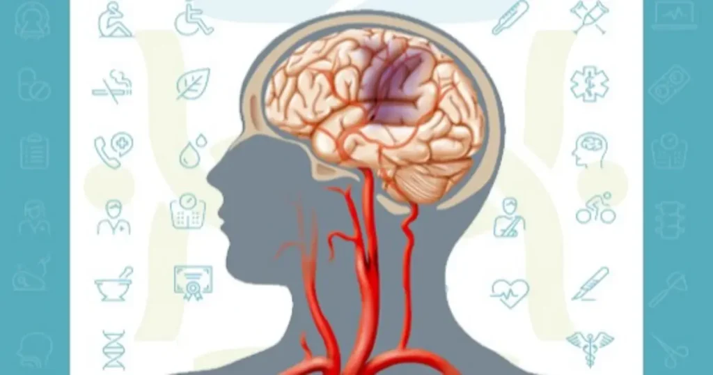 بیماری های مغز و اعصاب چیست + معرفی 5 نوع مختلف بیماری مغز و اعصاب