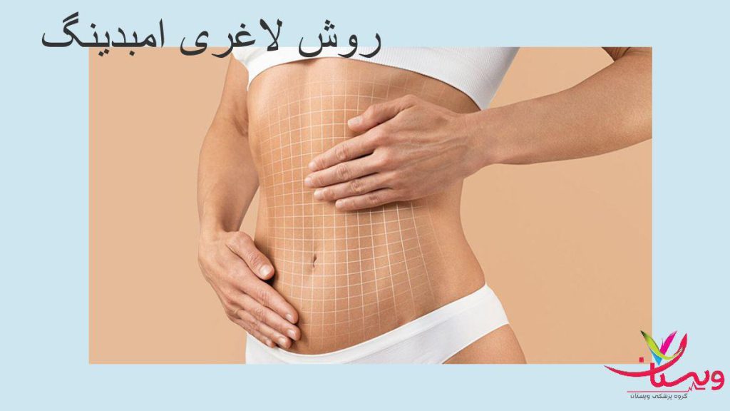 روش امبدینگ برای لاغری چیست + معرفی و بررسی کامل آن