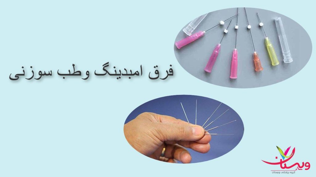 فرق امبدینگ وطب سوزنی چیست