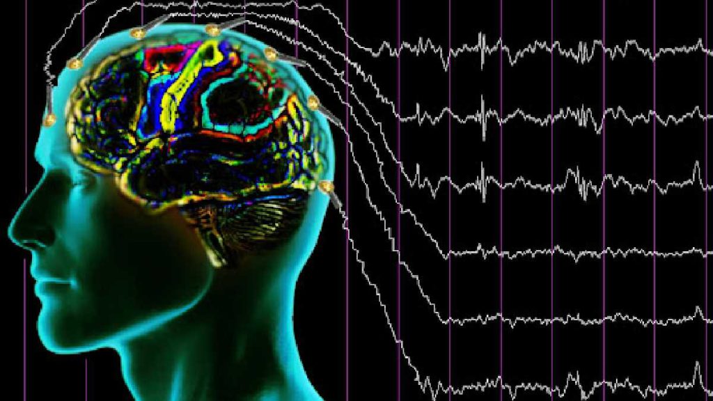 اختلال در نوار مغزی چیست