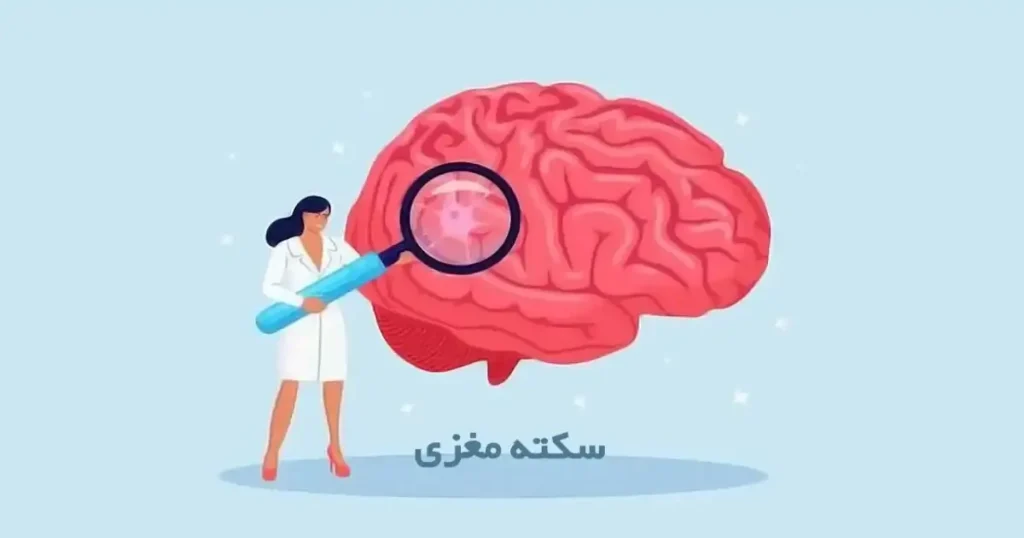 سکته مغزی چیست + معرفی و بررسی 10 علت و علامت سکته مغزی