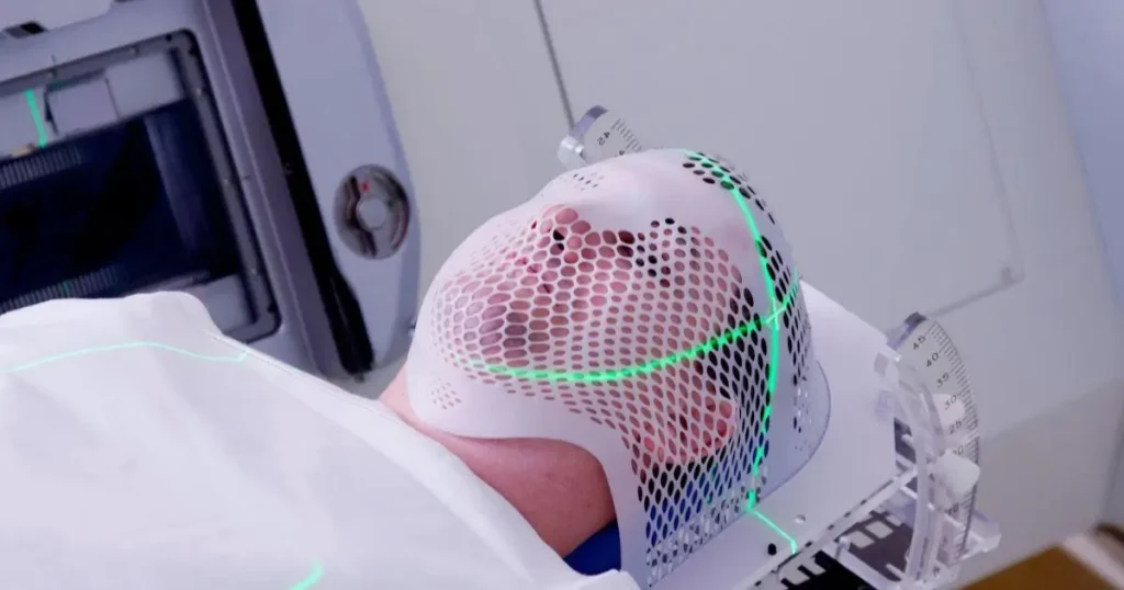 چگونه برای EEG آماده شویم