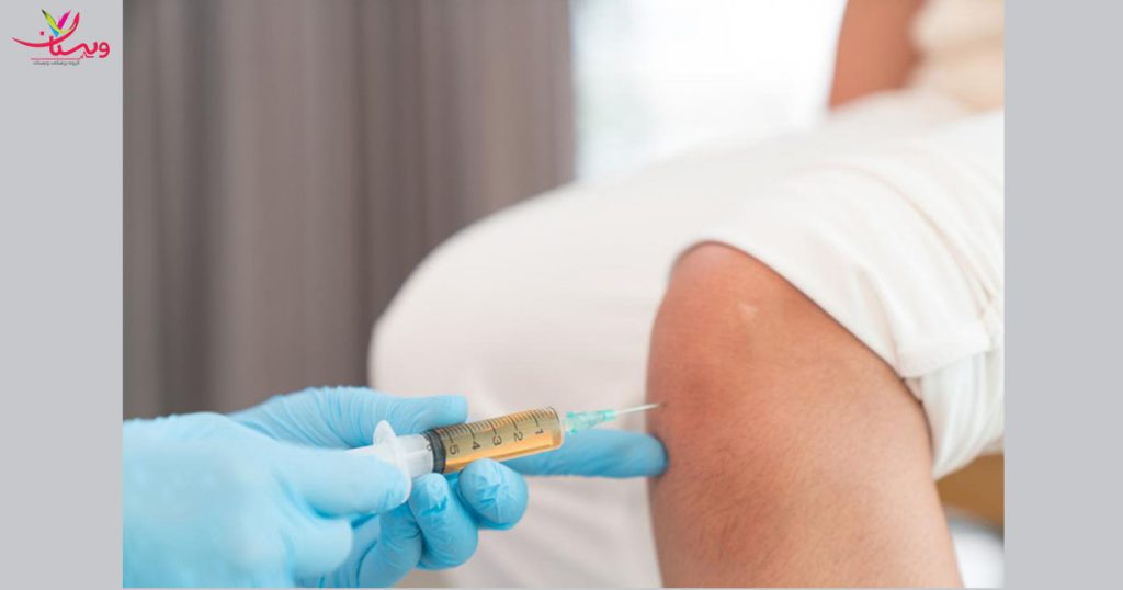 انواع روش های تزریق زانو روش های جایگزین پی آر پی زانو