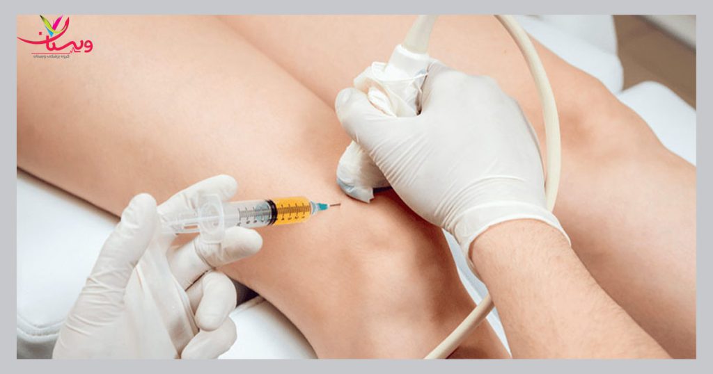 عوارض مهم پی ارپی مهم ترین عوارض تزریق پی آر پی زانو