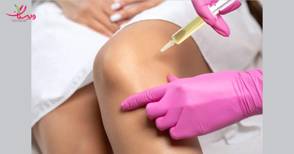 روش های جلوگیری از عوارض پیشگیری از عوارض تزریق prp در زانو