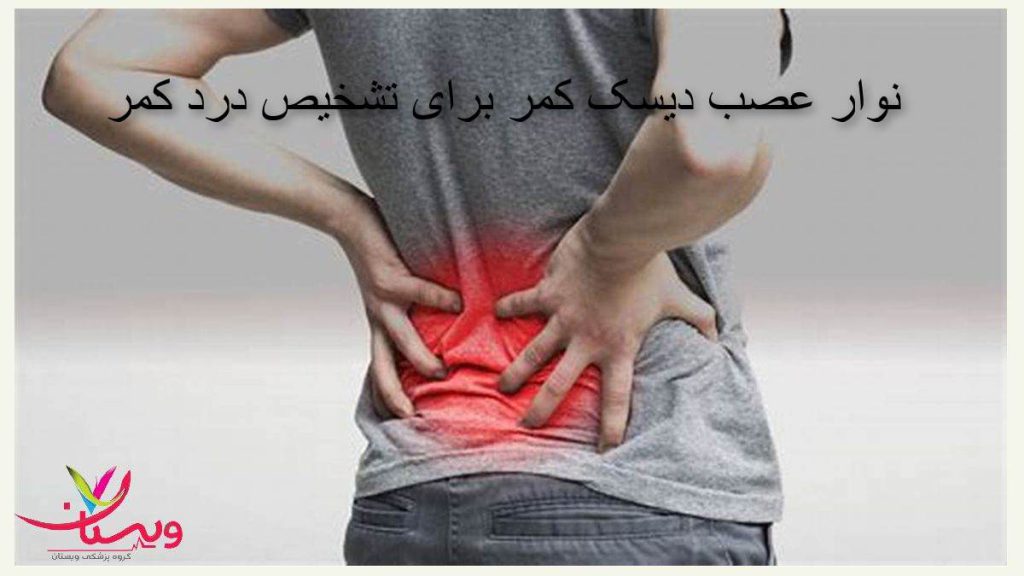 هزینه emgکمر نوار عصب دیسک کمر برای تشخیص درد کمر