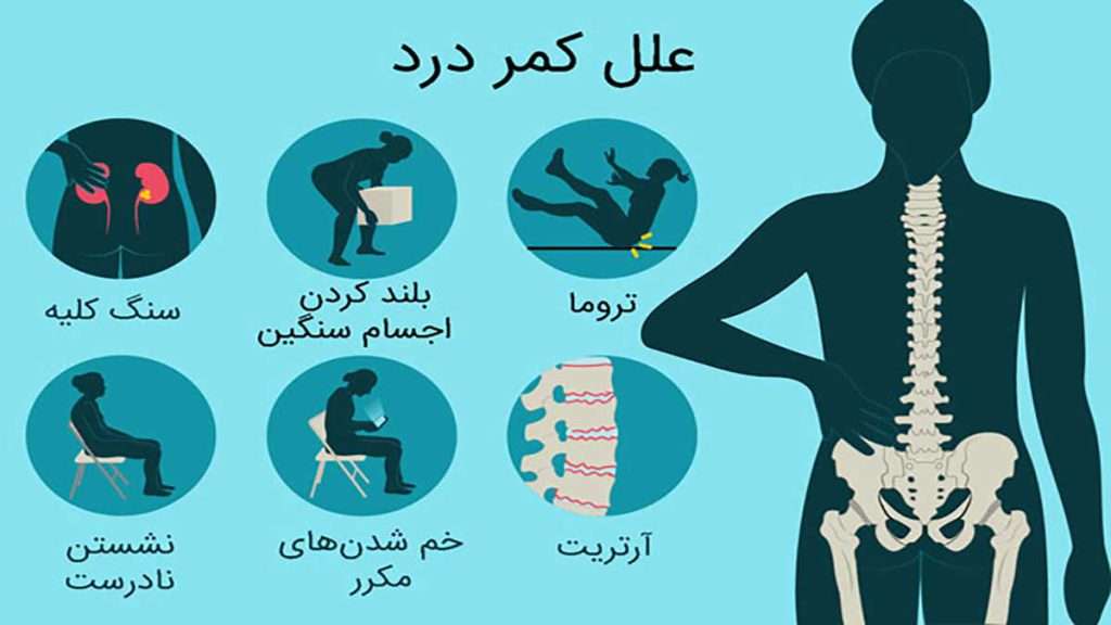 علت های کمر درد عواملی که باعث کمر درد میشود