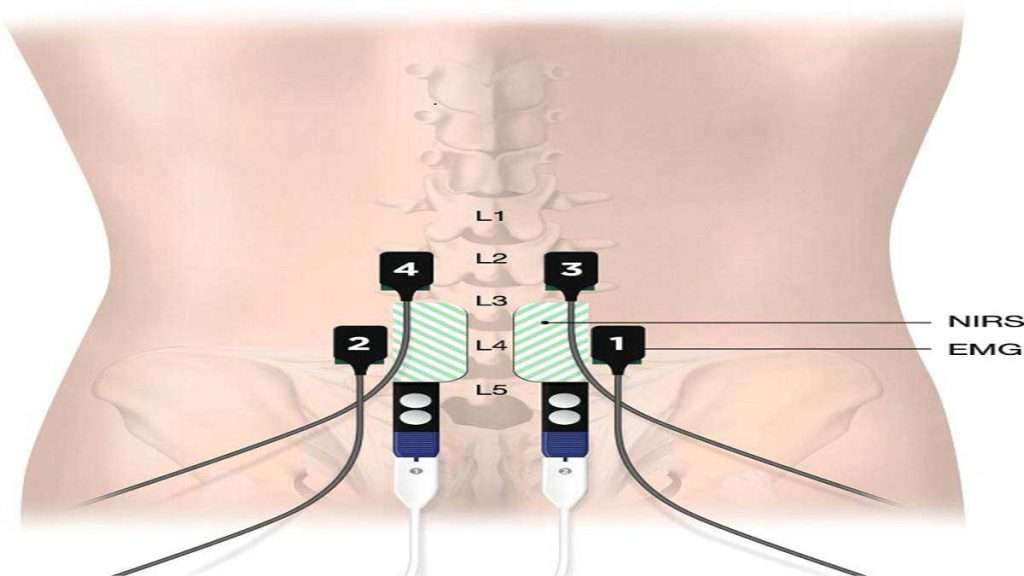 نوار عصب دیسک مرکز نوار عصب دیسک