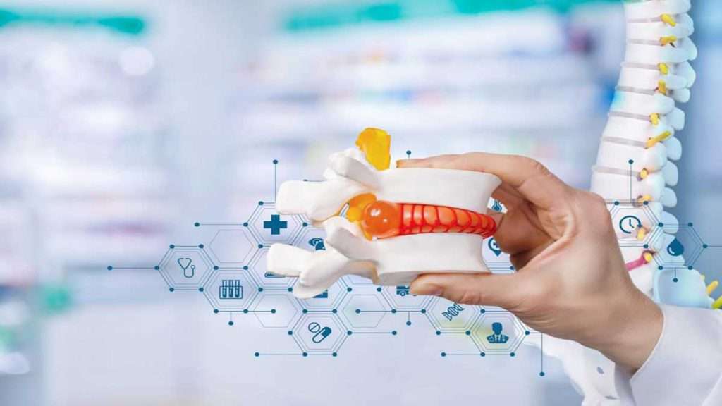 نوار عصب و عضله دیسک کمر