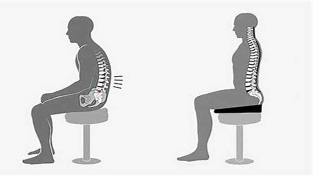 تاثیر فرم نشستن در درد سیاتیک