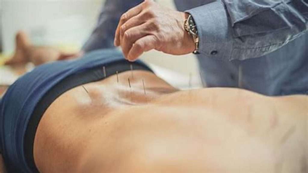 طب سوزنی و درمان سیاتیک درمان سیاتیک با طب سوزنی در ایران