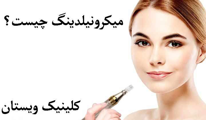 میکرونیلدینگ چیست؟ میکرونیلدینگ و نتیجه آن بر رووی پوست فرد نمایش داده می شود
