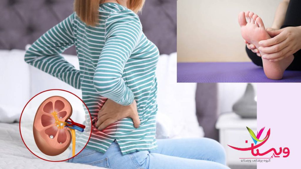 درد کف پا و کلیه 
