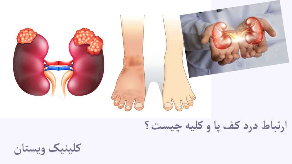کلیه و پاهای فرد بیمار را نشان می دهد