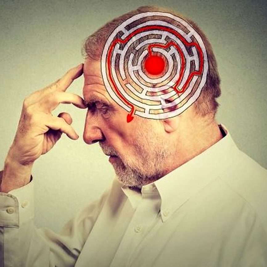 آلزایمر یک اختلال مغزی است که باعث بروز مشکلاتی در حافظه، تفکر و رفتار میشود
