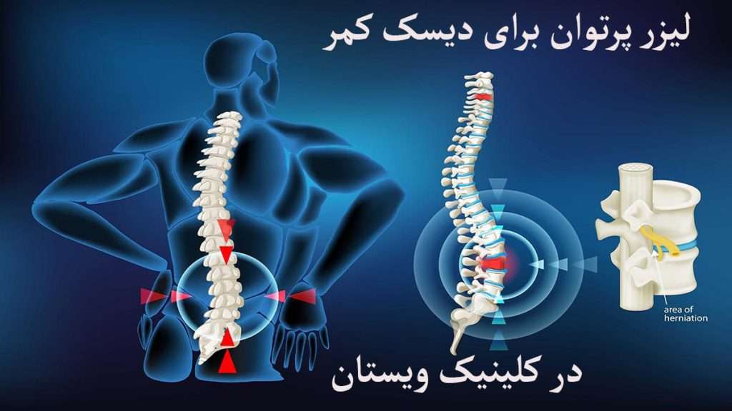 ستون فقرات فرد نمایش داده می شود