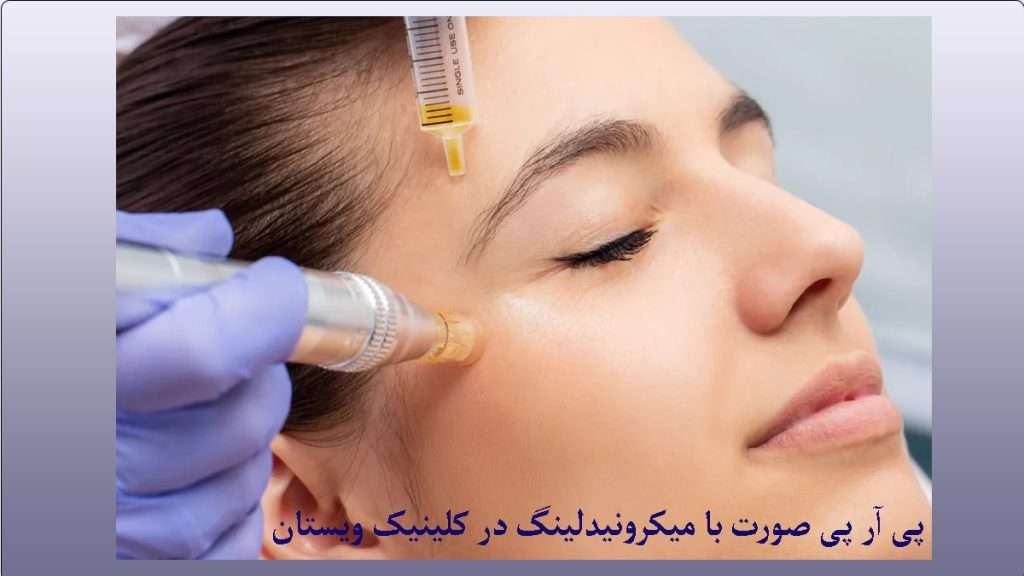 پزشک در حال پی آر پی صورت با میکرونیلدینگ می باشد