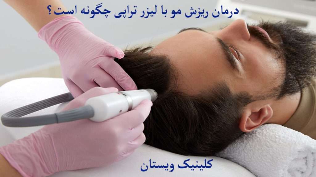 پزشک متخصص در حال انجام لیزر برای مو بیمار است