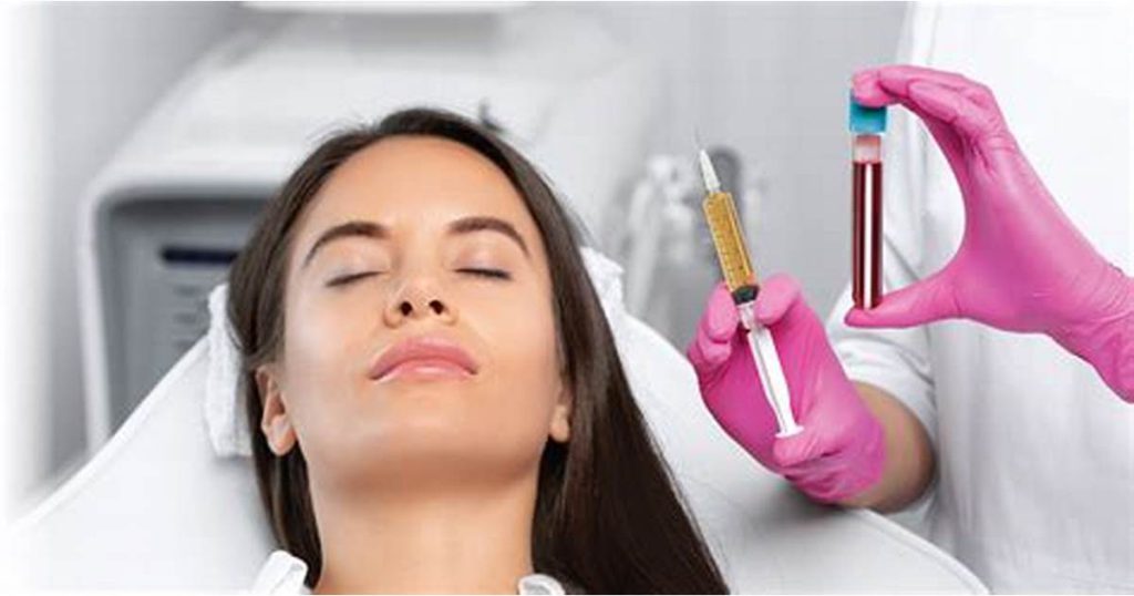 خانمی که برای تزریق پی آر پی صورت اماده شده است