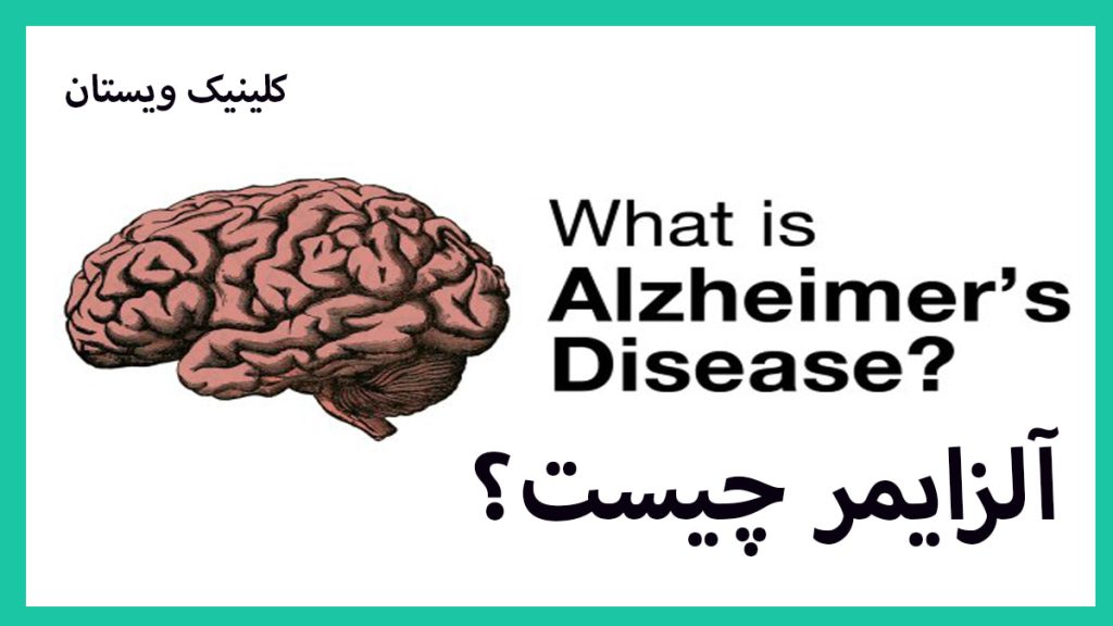 مغز در سمت چپ و نوشته ای با عنوان آلزایمر چیست در سمت راست