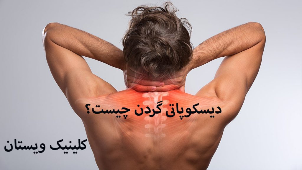 دیسکوپاتی گردن یک شخص که دارای دیسکوپاتی گردن و درد گردن است