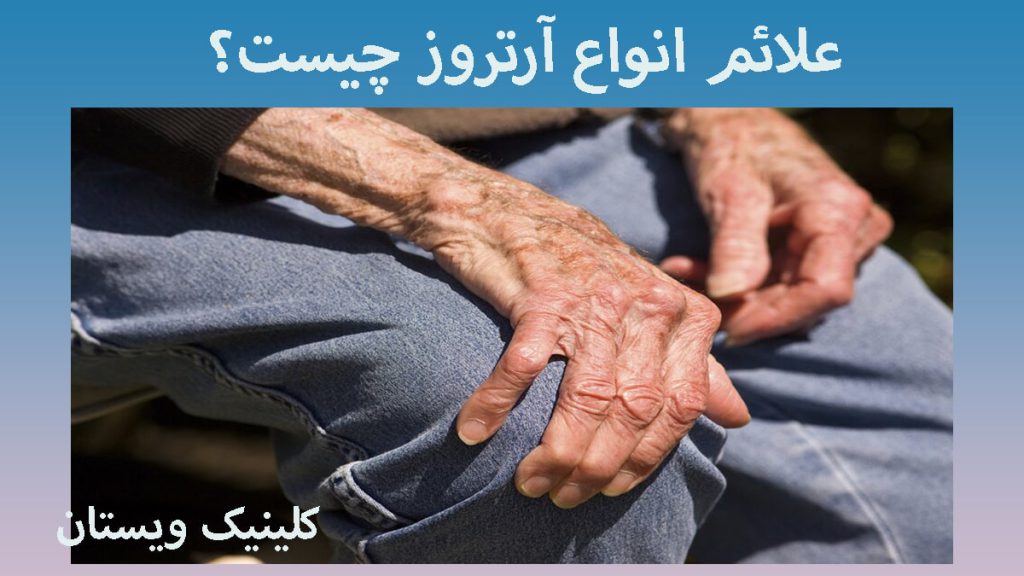 یک شخص مسن که به آرتروز مبتلا است و دستش را روی زانو گذاشته است