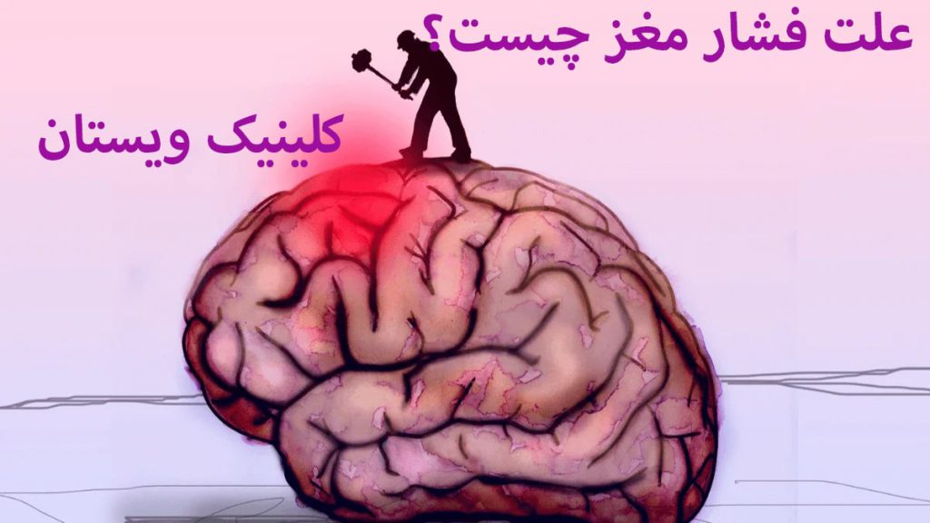 علت فشار مغز مغز و نوشته ای در خصوص علت فشار مغز نمایش داده می شود