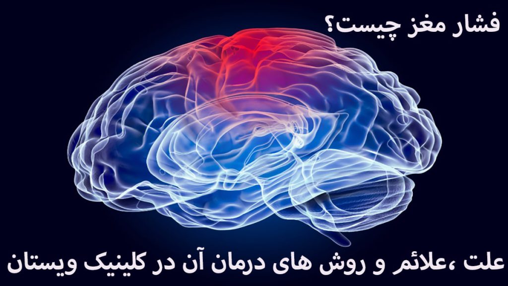 مغز و نوشته ای به عنوان فشار مغز نمایش داده می شود