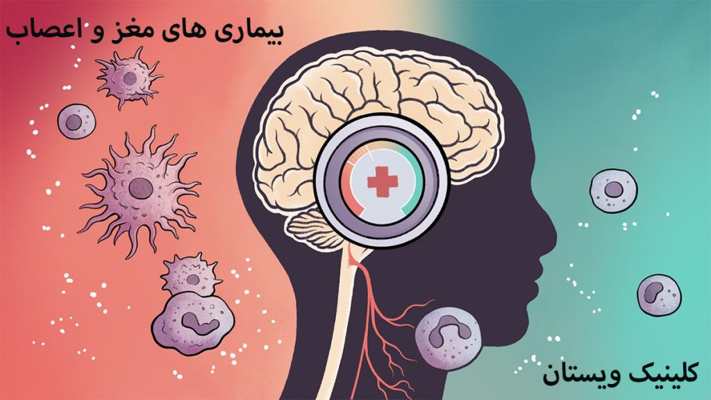 مغز و اعصاب مغز فرد به همراه نشانه هایی از بیماری نمایش داده می شود