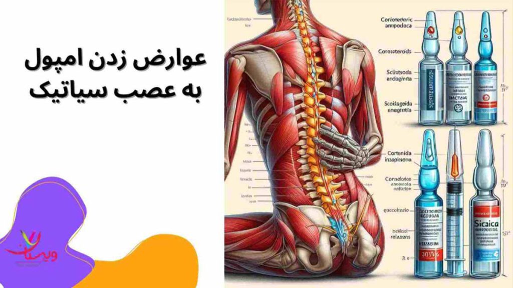 عوارض زدن امپول سیاتیک 