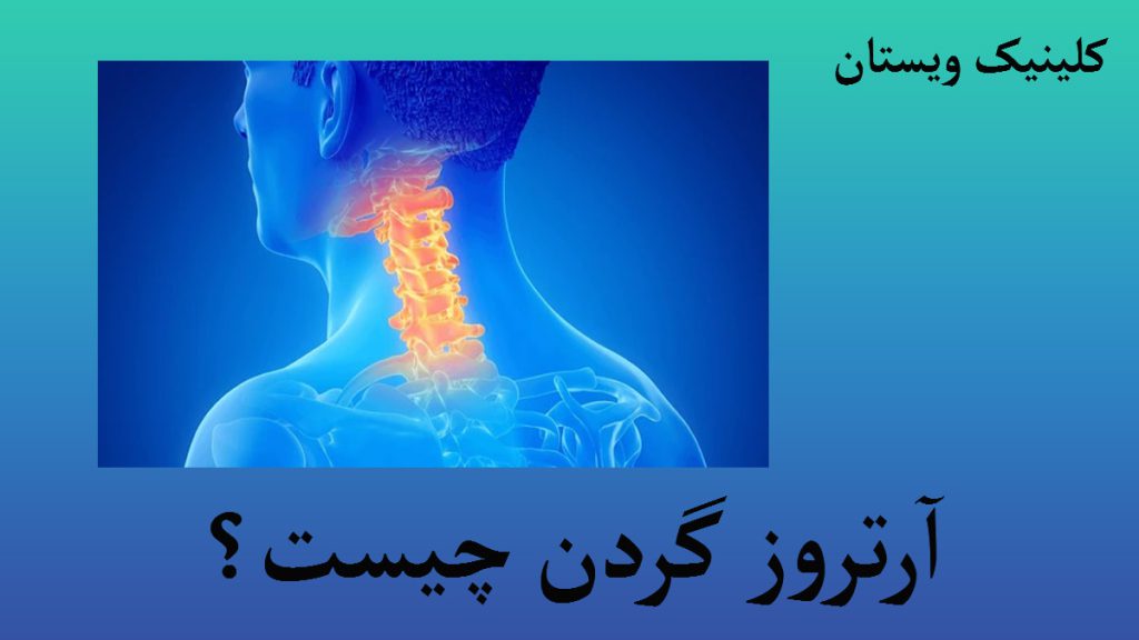 مهره های گردن با رنگ زرد-زمینه آبی