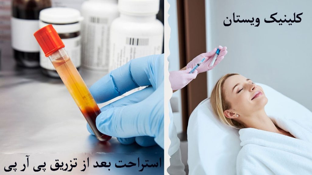 استراحت بعد از پی ار پی یک خانم در سمت راست در حال استراحت و در سمت چپ یک ظرف حاوی پی ار پی در دست پزشک