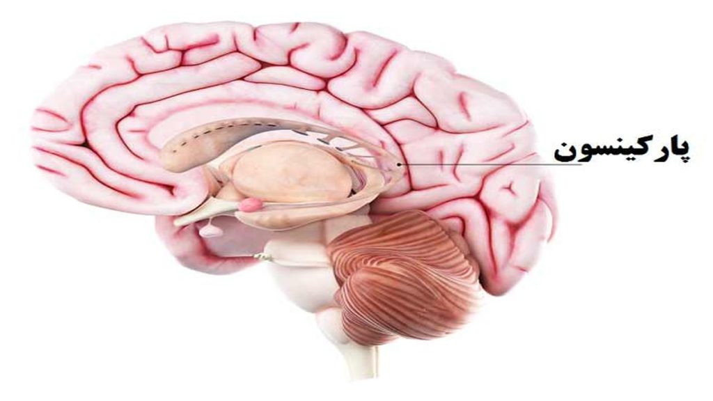 نورولوژیست