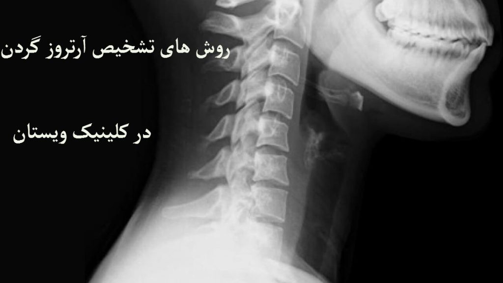 یک عکس رادیولوژی از مهره های گردن