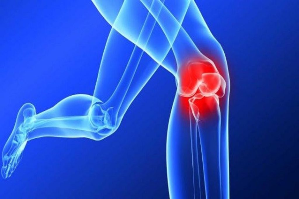 رباط صلیبی کدام قسمت زانو قرار گرفته است رباط صلیبی کجاست؟ بهترین متخصص درمان پارگی رباط صلیبی زانو