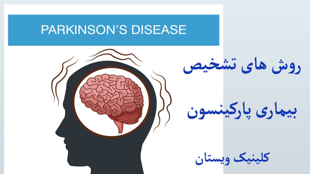 تشخیص پارکینسون تصویری نمادین از مغز با زمینه سفید