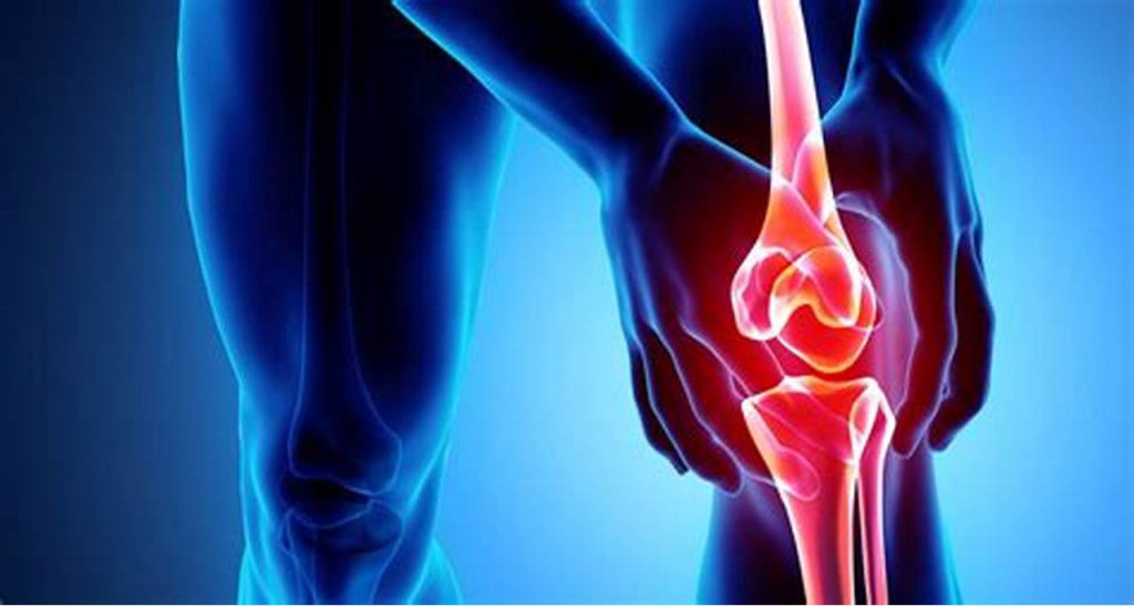 زانویی که دچار پارگی رباط صلیبی شده