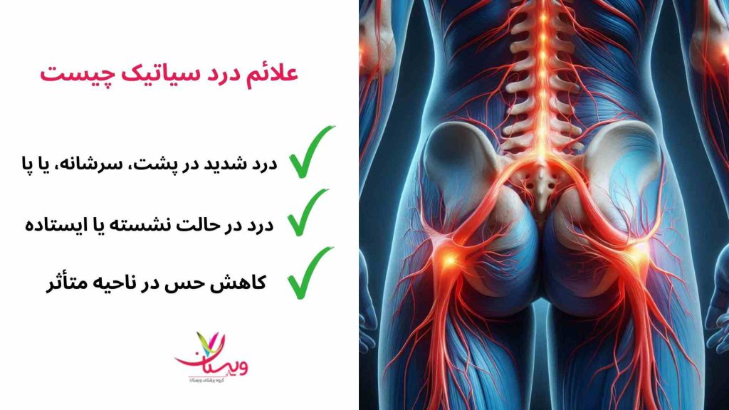 علائم درد سیاتیک
