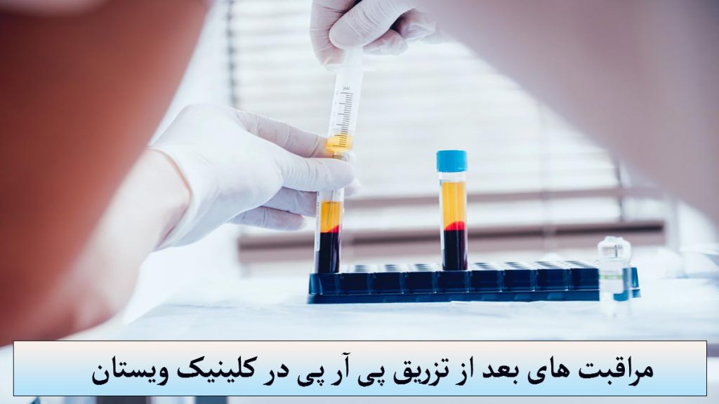 مراقبت بعد از پی ار پی دو عدد ظرف حاوی پی ار پی و دستهای یک شخص نشان داده می شود