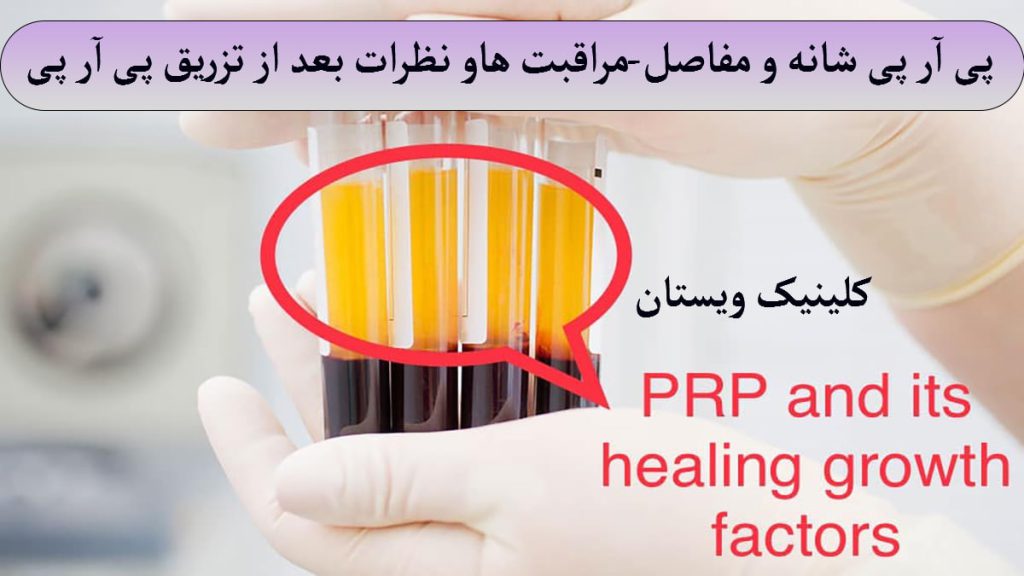 مرکز پی ار پی یک پزشک که چند عدد ظرف حاوی پی ار پی در دست دارد