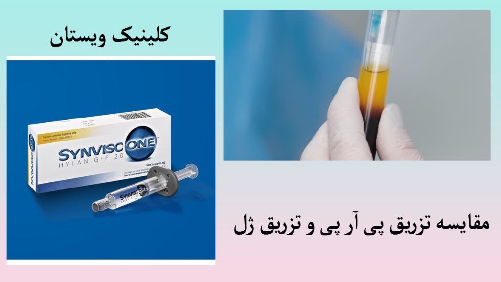 مقایسه پی ار پی و ژل برای مفاصل یک ظرف حاوی پی ار پی و یک ژل برای مفاصل دیده می شود