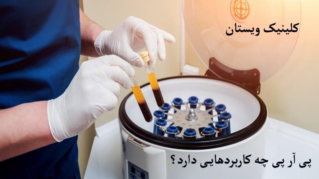کاربرد پی ار پی یک سانتریفیوژ و یک شخص در حال قرار دادن نمونه در آن