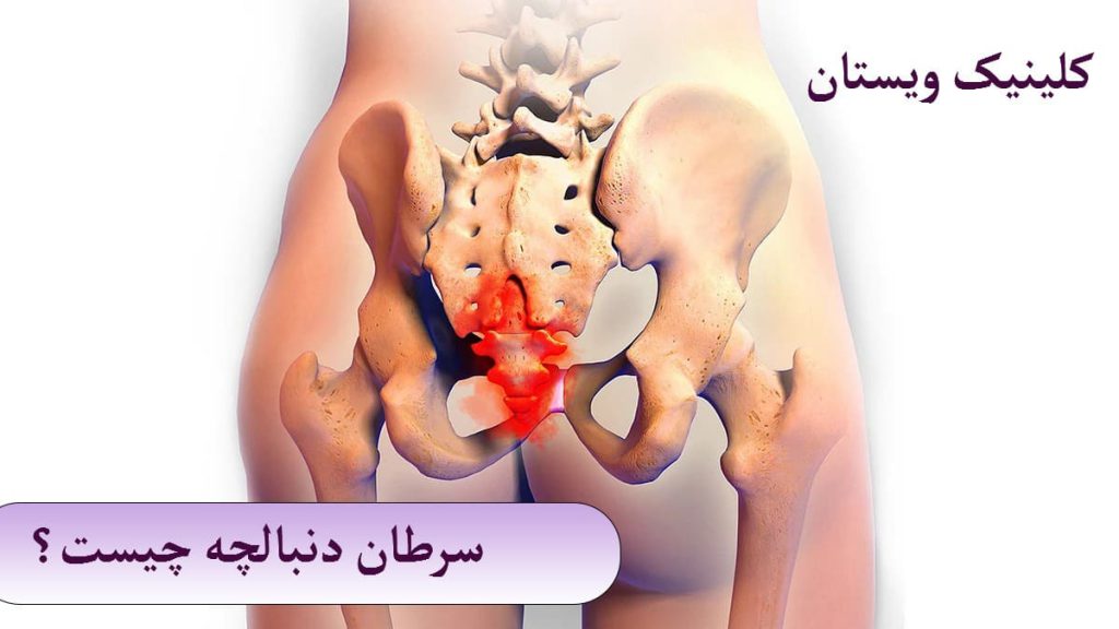 سرطان استخوان دنبالچه چیست؟