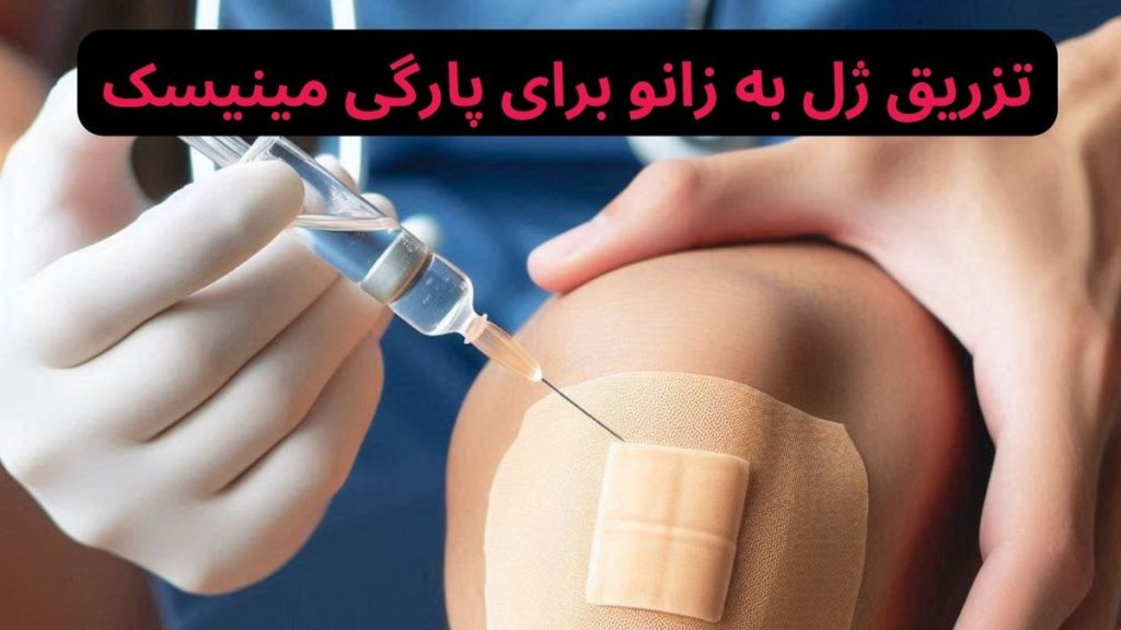 تزریق ژل به زانو برای پارگی مینیسک