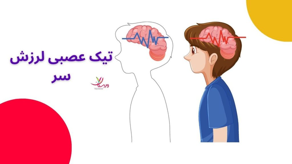 تیک عصبی لرزش سر