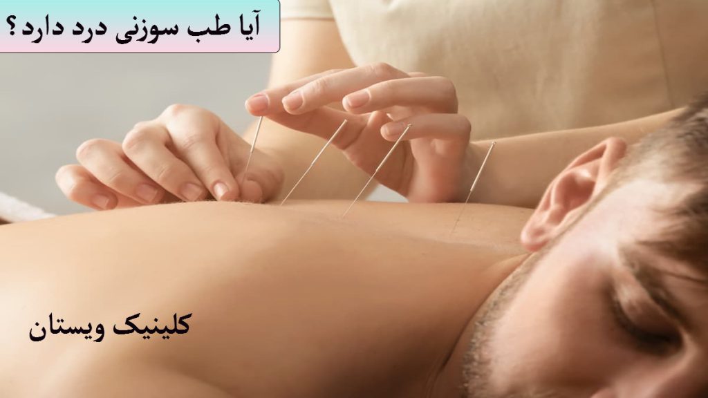 یک پزشک طب سوزنی در حال انجام طب سوزنی کتف
